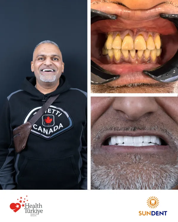 Before and After Treatment 11