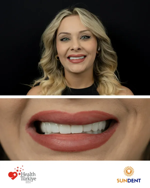 Before and After Treatment 16