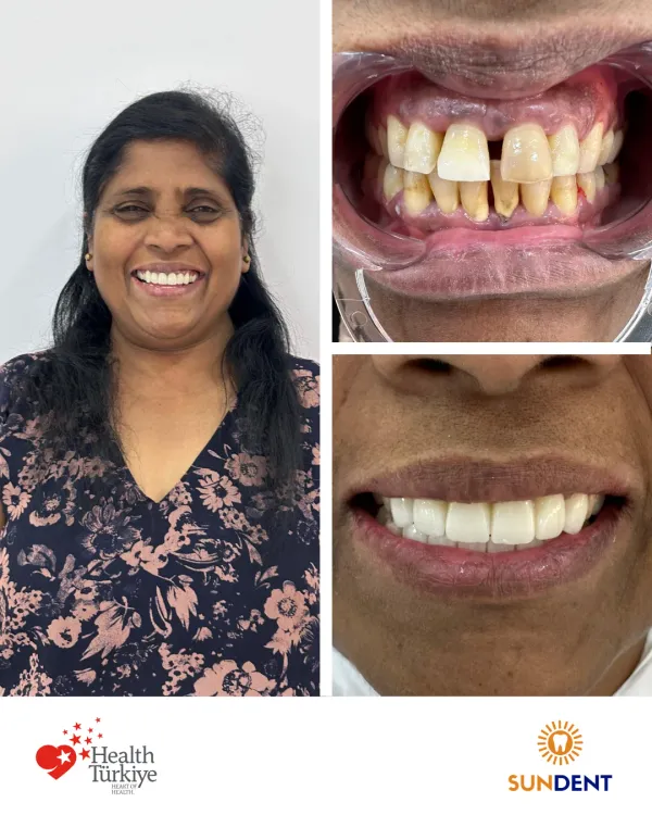 Before and After Treatment 7