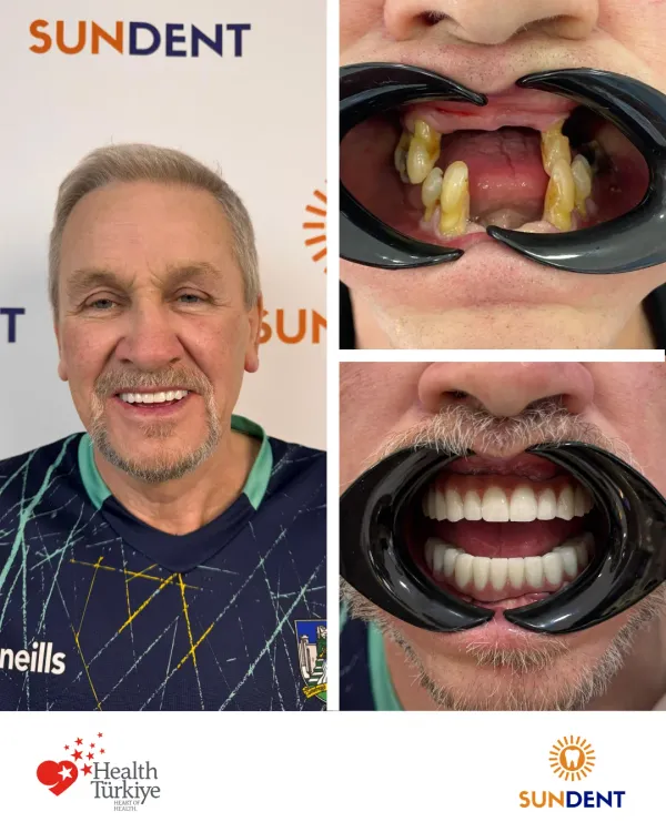 Before and After Treatment 8