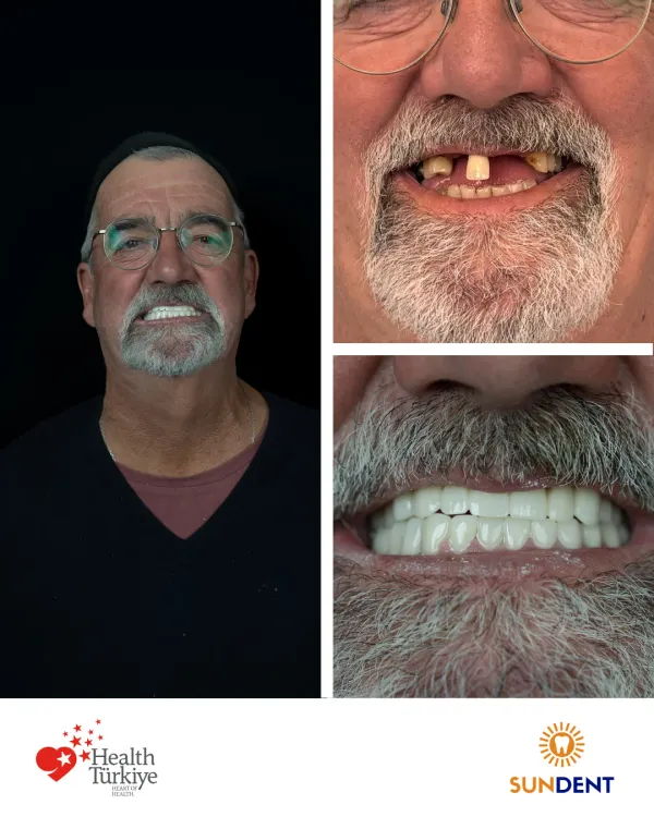 Before and After Treatment 9