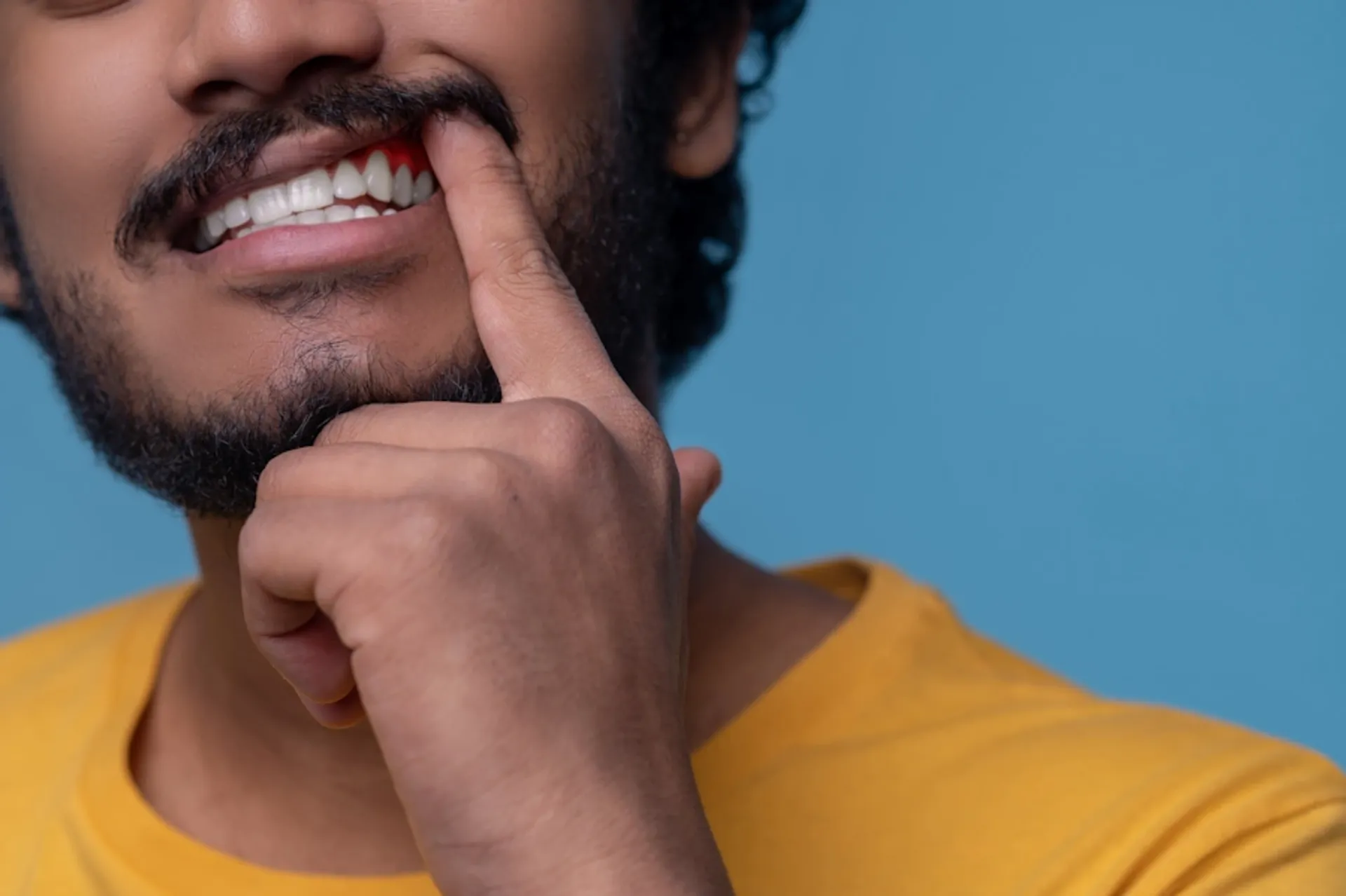 Gum Diseases